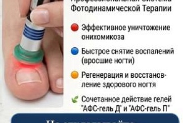 Фотодинамическая терапия (ФДТ) на аппарате «АФС-Подолог»!