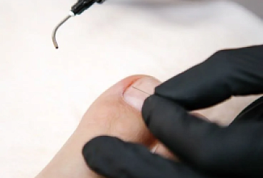 Скоба 3ТО 1 ед. 